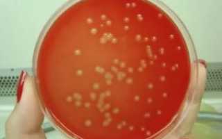 Streptococcus agalactiae лечение