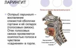 Воспаление связок горла лечение